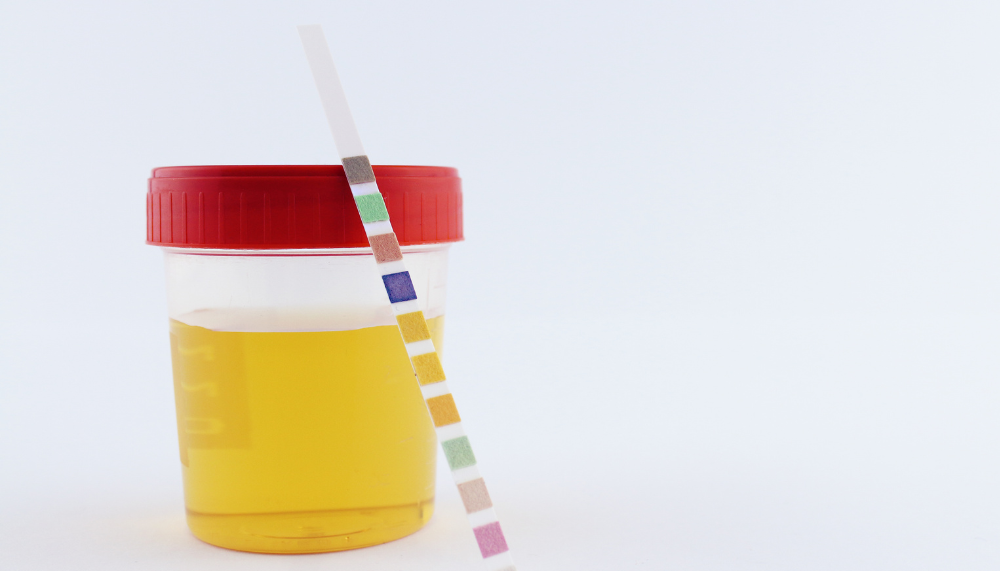Bandelettes de test urinaire